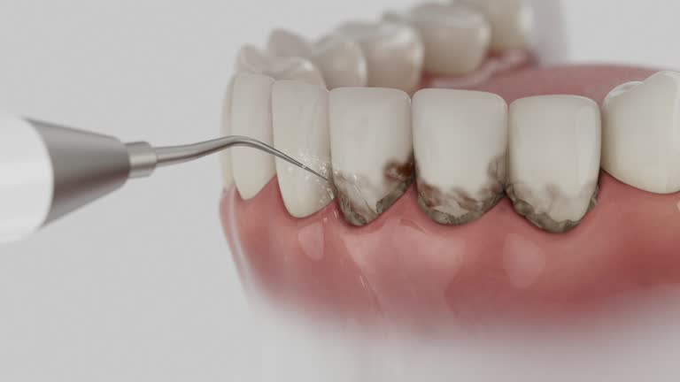 Reliable Root Canal Treatment contractor in USA by Dentist Open Now